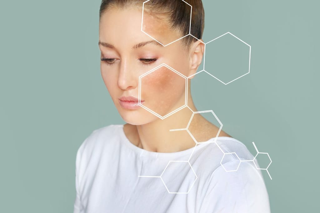 Nainen katsoo alaspäin vaaleaa taustaa vasten. Hänen kasvoillaan näkyy pigmenttialue, ja kuvan päällä on graafisia molekyylikuvioita, jotka viittaavat ihonhoitoon tai ihon rakenteeseen. 