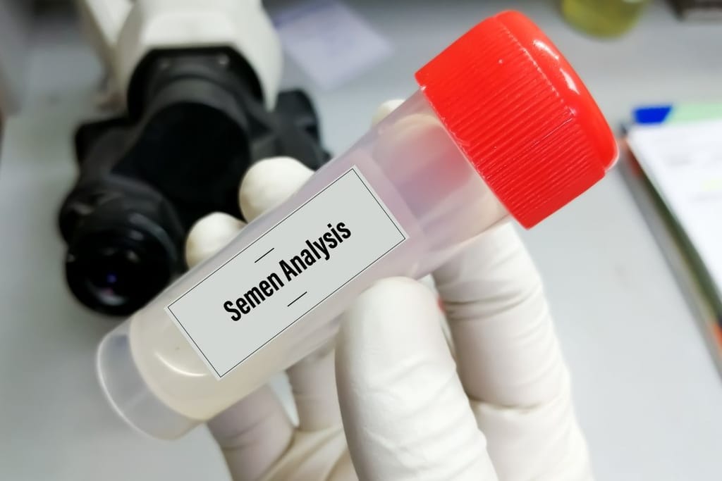 Laboratoriossa pidetty näyteputki, jossa lukee “Semen Analysis”.