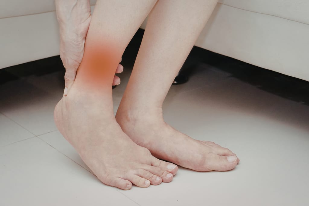 Henkilö pitää toista jalkaansa. Jalat turvoksissa.