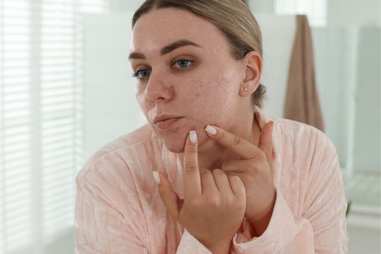 Nuori nainen tarkastelee kasvojensa ihoa kylpyhuoneessa ja osoittaa sormella leukaan ilmestynyttä näppylää peilin edessä.