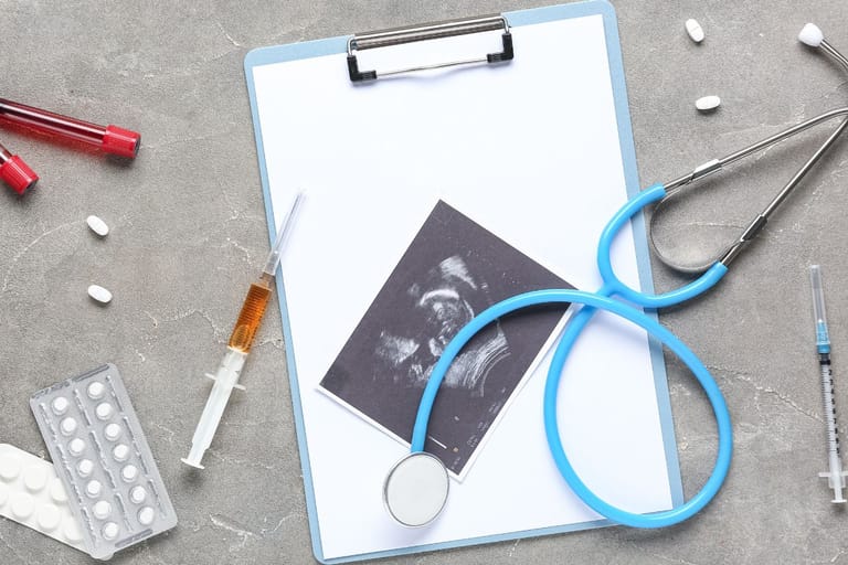 IVF-hoitoihin käytettäviä välineitä, kuten ruisku, pillereitä ja stetoskooppi sekä kaksi putkea verinäytteitä. Lääkärin kirjoitusalustan päällä on lomake ja ultrakuva.