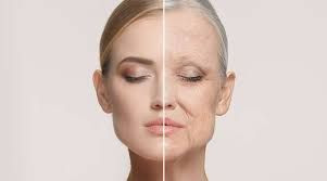 Aging skin